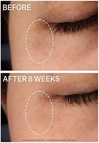 šviesinantis paakių serumas "Strivectin Multi-Action Super-C Dark Circle Brightening Eye Serum" 15ml