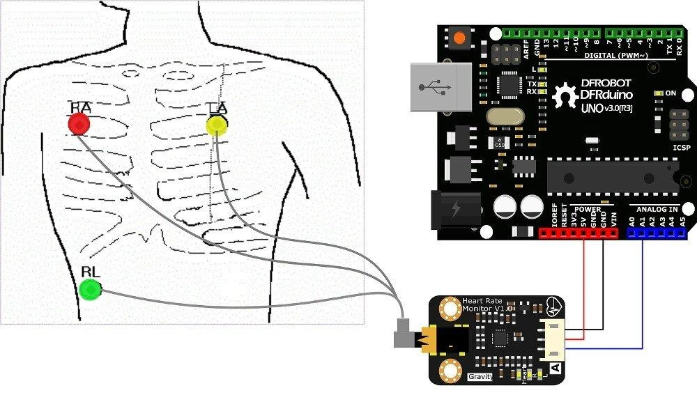 DFRobot Gravity analoginis širdies ritmo stebėjimo jutiklis (EKG), skirtas Arduino