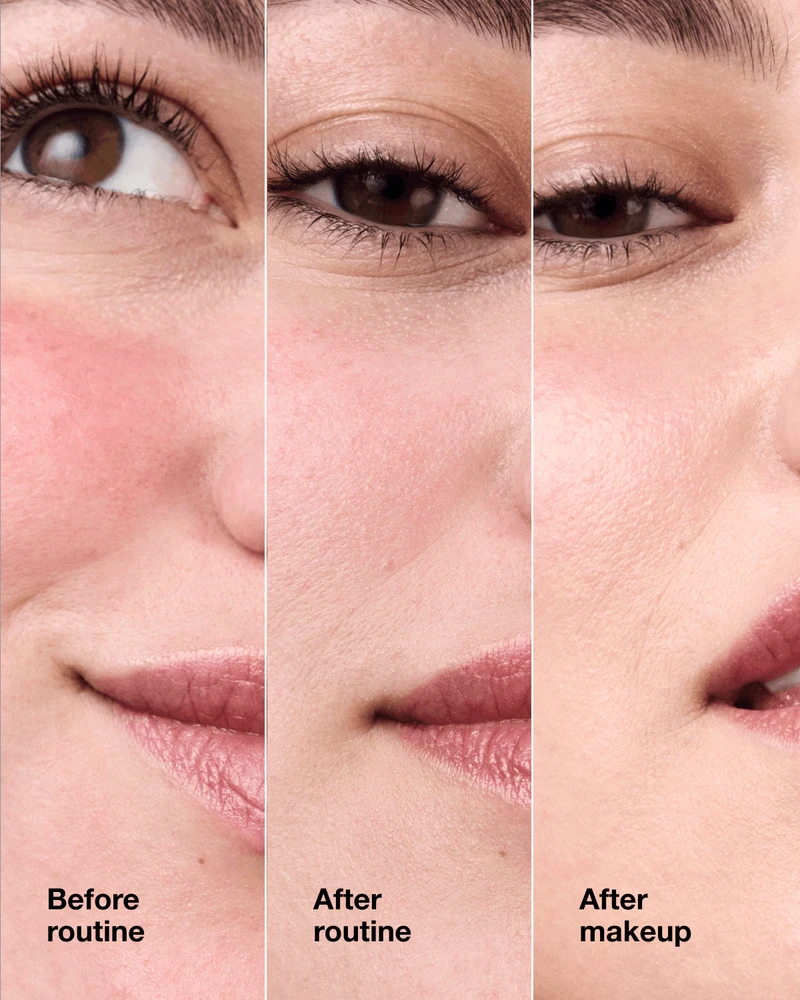 Clinique Redness Solutions Makeup SPF 15 - Raudonį maskuojantis makiažo pagrindas su SPF15, 30 ml | spalva: 06 Calming Vanilla