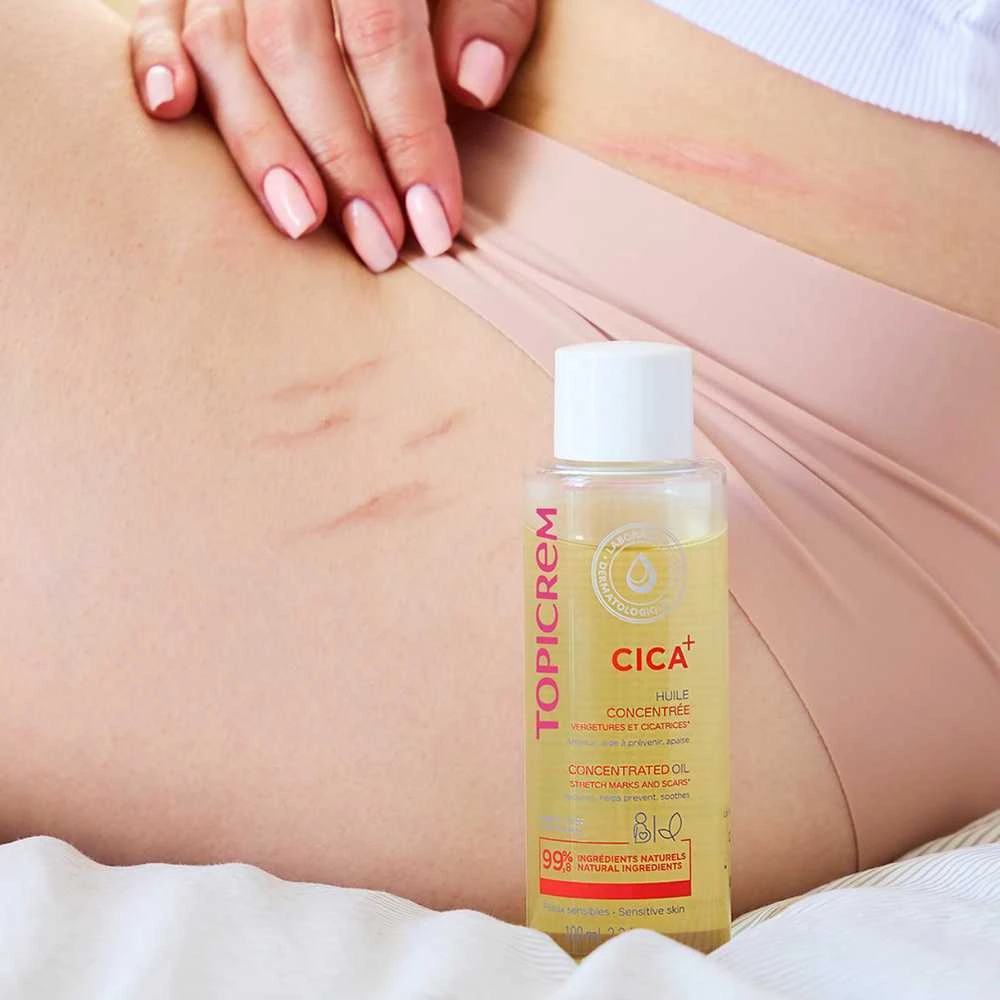 Koncentruotas aliejus nuo strijų ir randų Topicrem CICA+, 100 ml