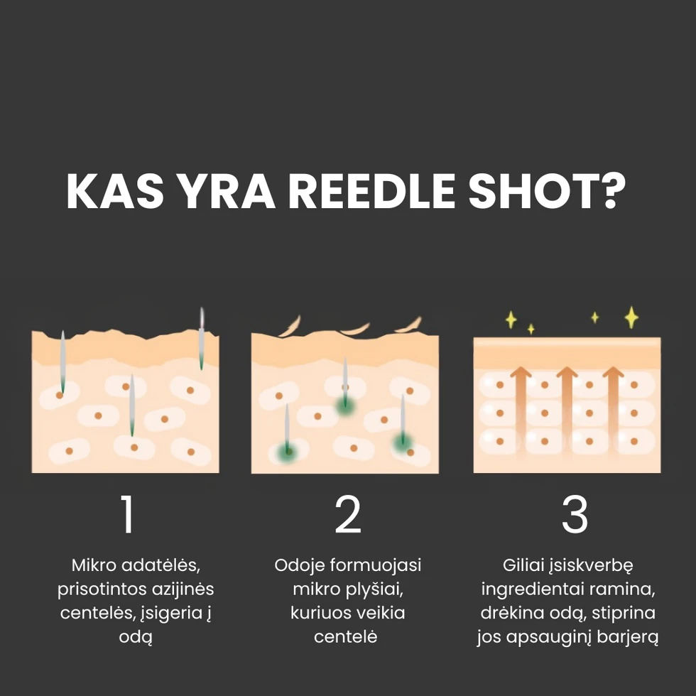 VT Cosmetics Reedle Shot 300 Intensyvaus poveikio serumas, 50 ml