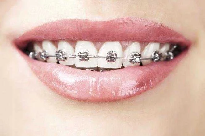 Atos PASTA SALVIA ORTHO DENTAL NIGHT 75M