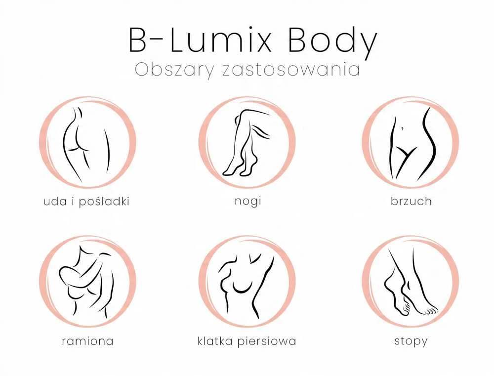„Beautifly B-Lumix“ korpusas