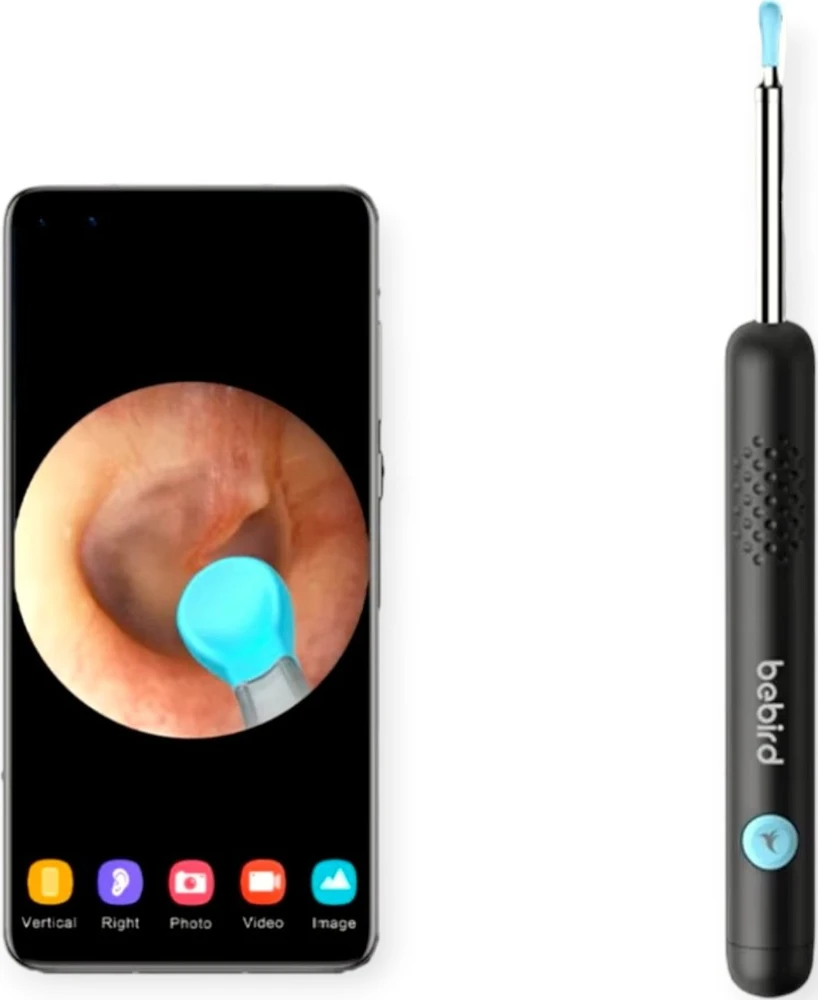 Smart Visual Ear-Clean strypas Bebird R1 juodas