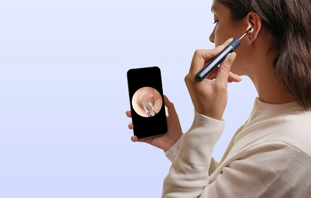 Smart Visual Ear-Clean Rod Bebird Note 5 pro (balta)