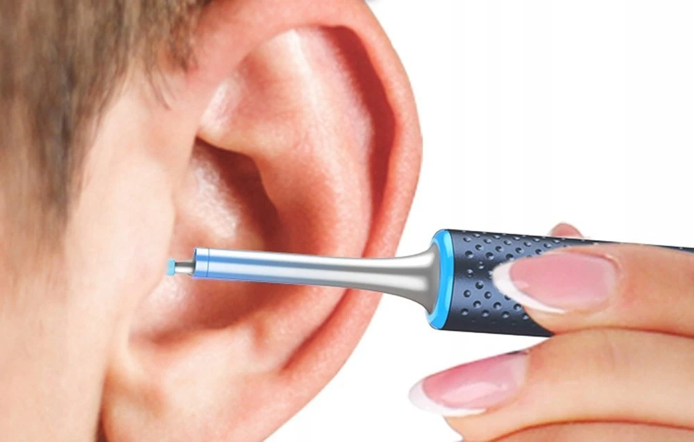 Smart Visual Ear-Clean Strypas Bebird M9 S (juodas)
