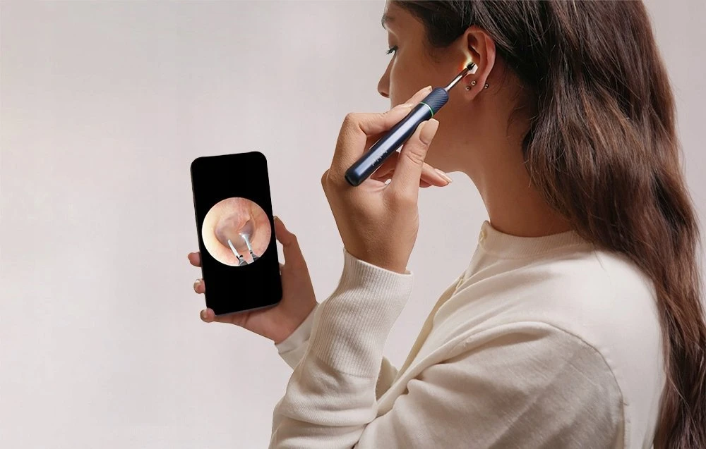 Smart Visual Ear-Clean Rod Bebird Note 5 pro (balta)