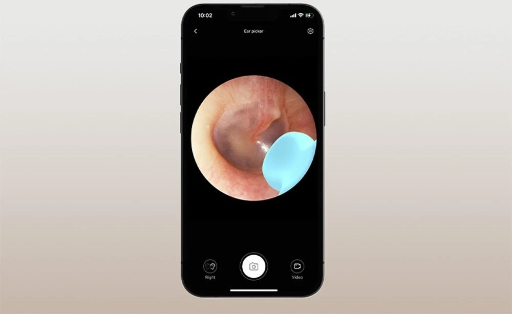 Smart Visual Ear-Clean Strypas Bebird M9 S (juodas)