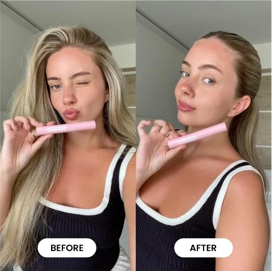 „Hairburst“ – plaukų tramdiklis kūdikiams, 12 ml