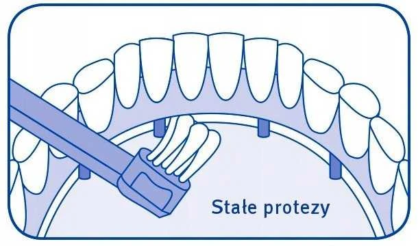 „Curaden Curaprox CS 708 Implant“ ortodontinis implantas (1 vnt.)