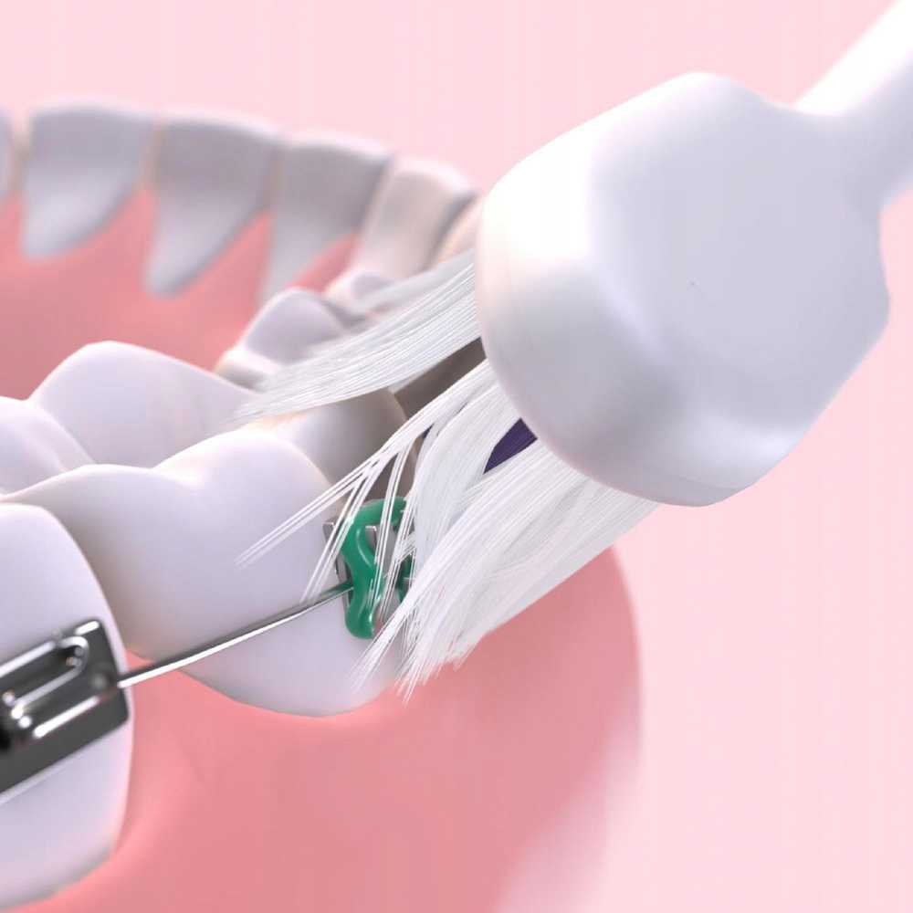 Dėklas Šepetėlis DD-Print SONIC ORTHO 4102
