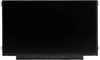 Coreparts Mikroekranas „MicroScreen“ 11,6 colio LCD HD matinis