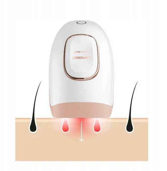 Fotoepiliatorius Concept IL3000