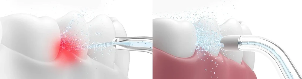 Oclean Oral Irrigator Oclean A10 Žalias