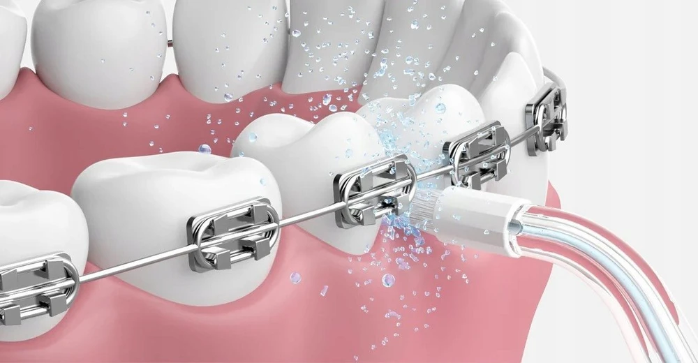 Oclean Oral Irrigator Oclean A10 Žalias