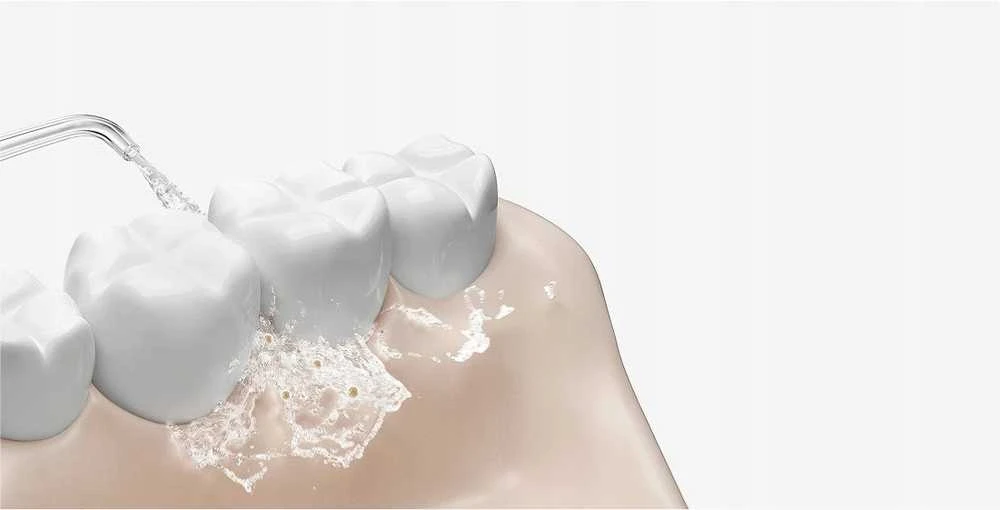Irigatorius Xiaomi Water Flosser 2
