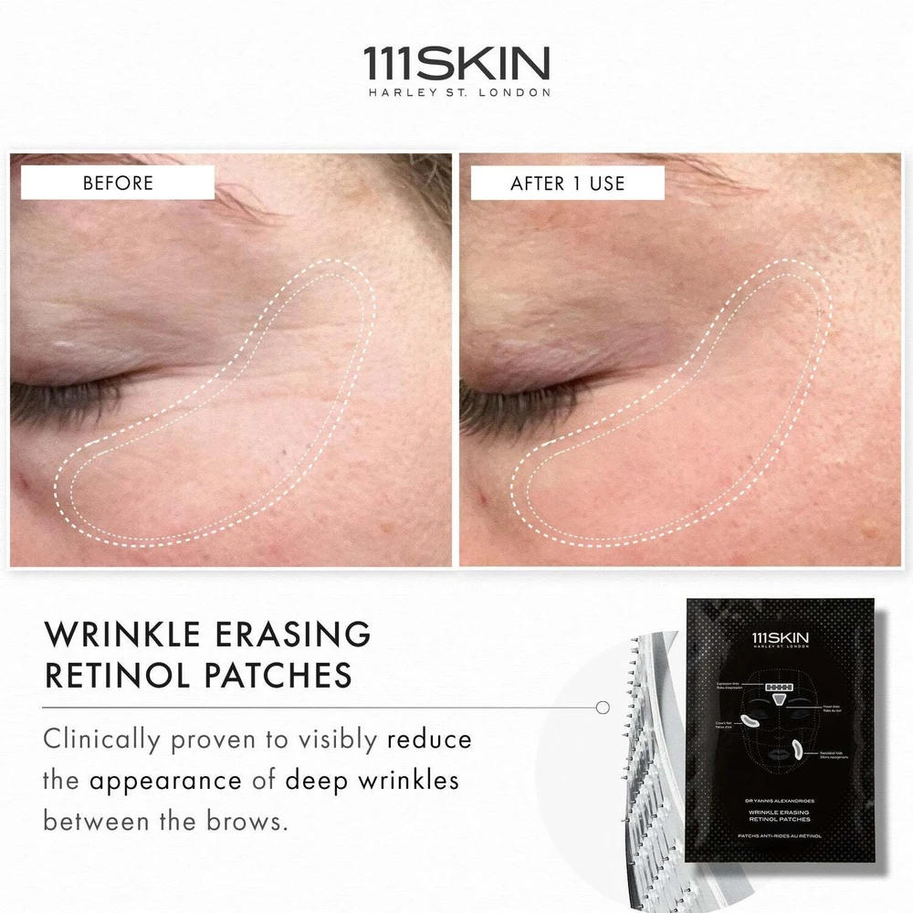 Its Skin 111Skin Raukšles mažinantys retinolio pleistrai 3x35g