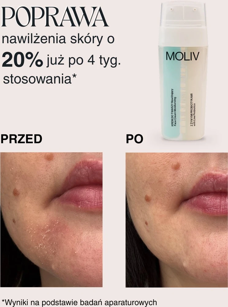 Moliv BE`LIV drėkinantis veido kremas su gyvais probiotikais 30ml