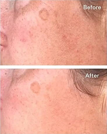 Murad odos priežiūros priemonė Murad Correct & Protect serumas SPF45 PA++++, 30 ml