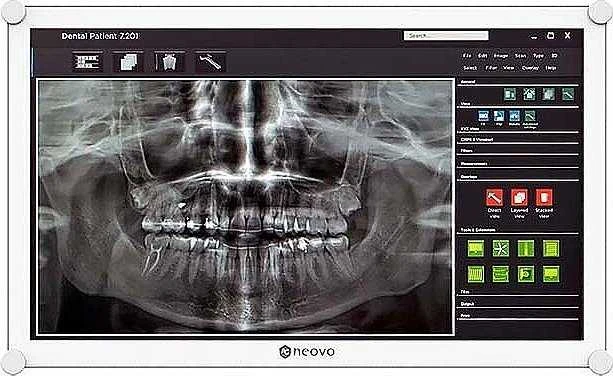 Monitorius Neovo DR-2202 21,5 IN FHD 1920 x 1080