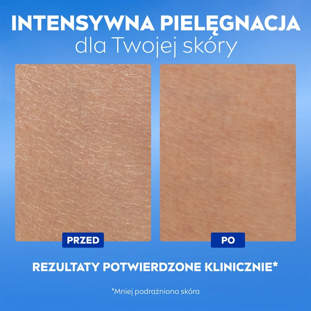 „Nivea Repair & Care“ regeneruojamasis serumas-kūno balzamas, 200 ml