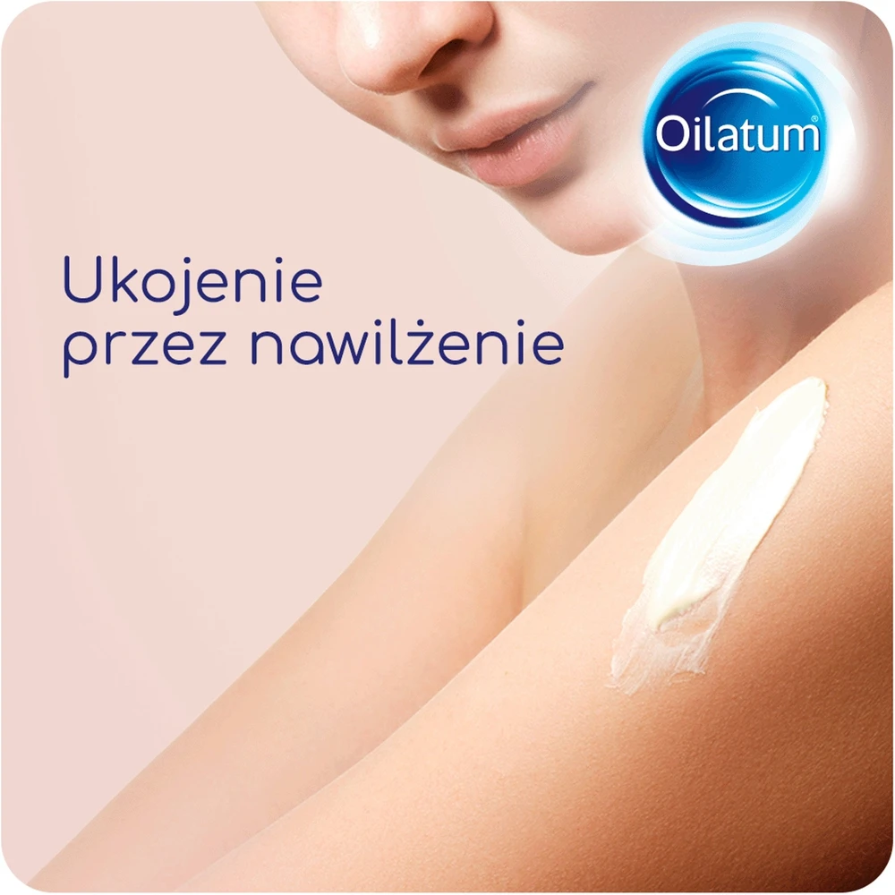 Oilatum Formula Med kūno kremas sausai ir į atopiją linkusiai odai 300 ml