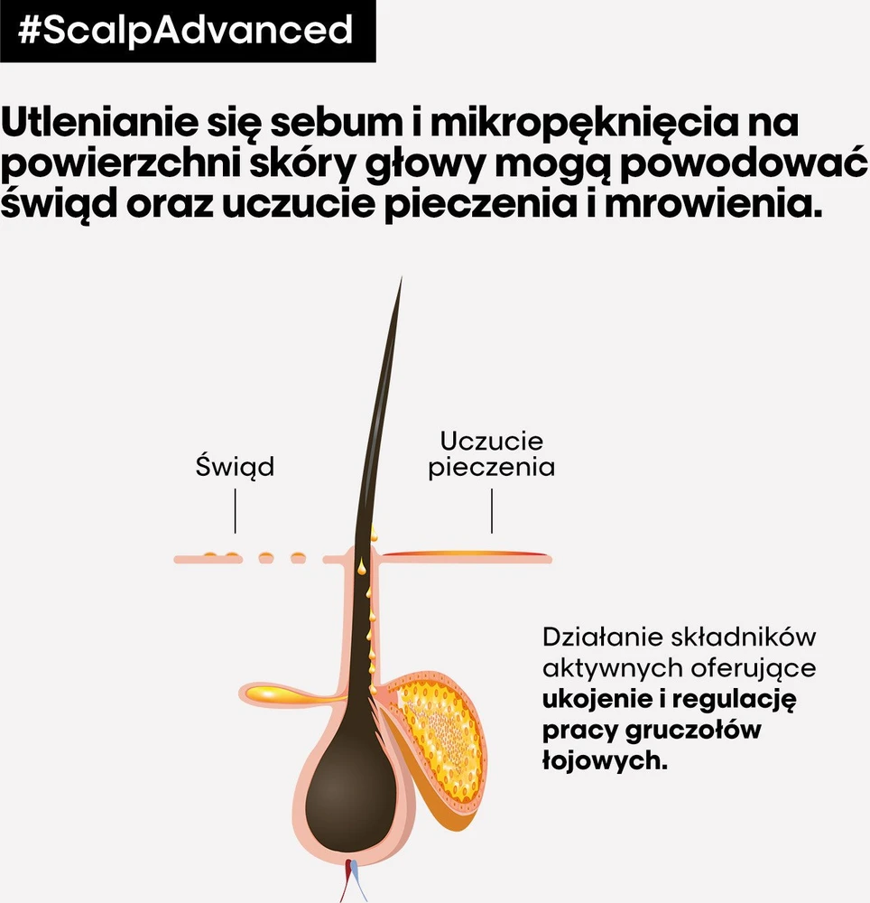 L'Oreal Professionnel Serie Expert Scalp Advanced Hair šampūnas nuo diskomforto, 300 ml