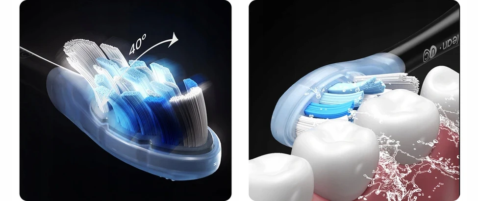 Dantų šepetėlis „Oclean X Ultra“ 20 mėtų