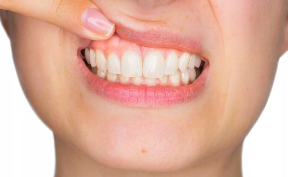 Vitis VITIS GINGIVAL Rinkinys PODRÓZNY
