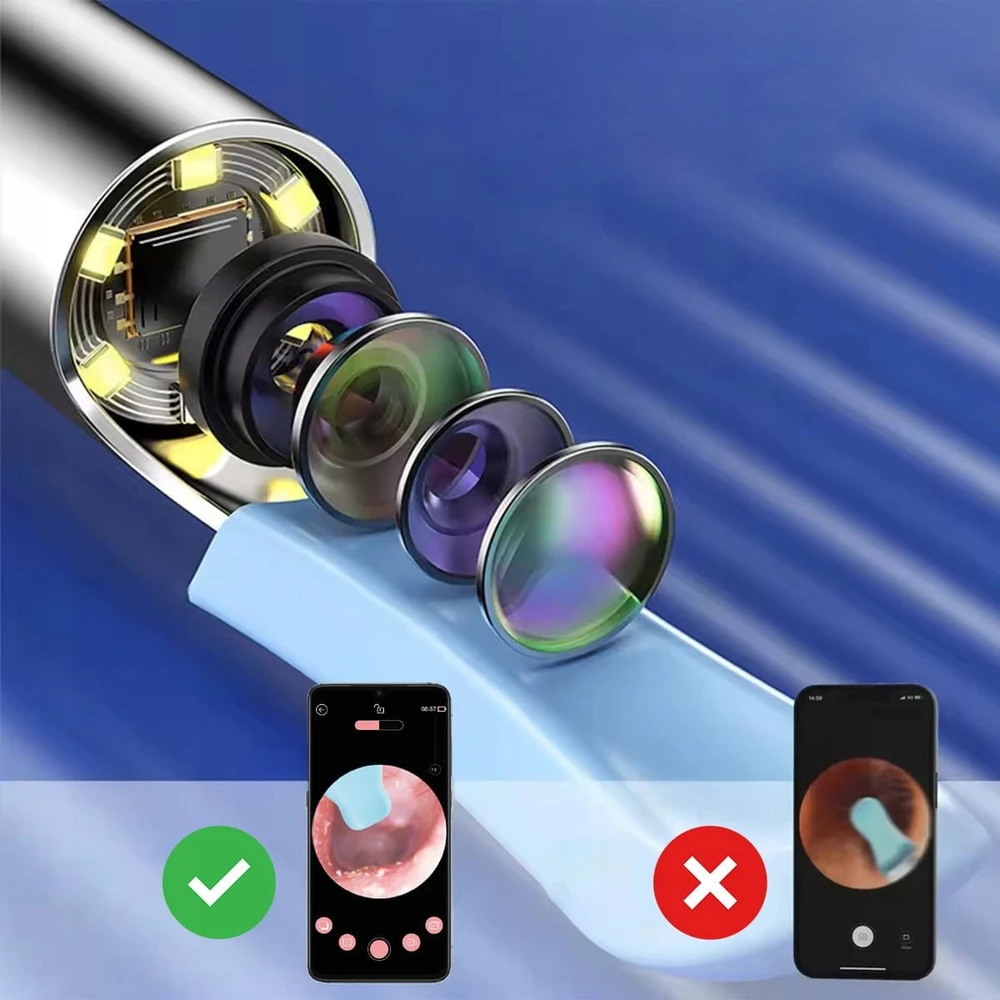 „Zenwire“ ausų valymo endoskopas otoskopas ausų sieros valymo prietaisas kamera WiFi SMART