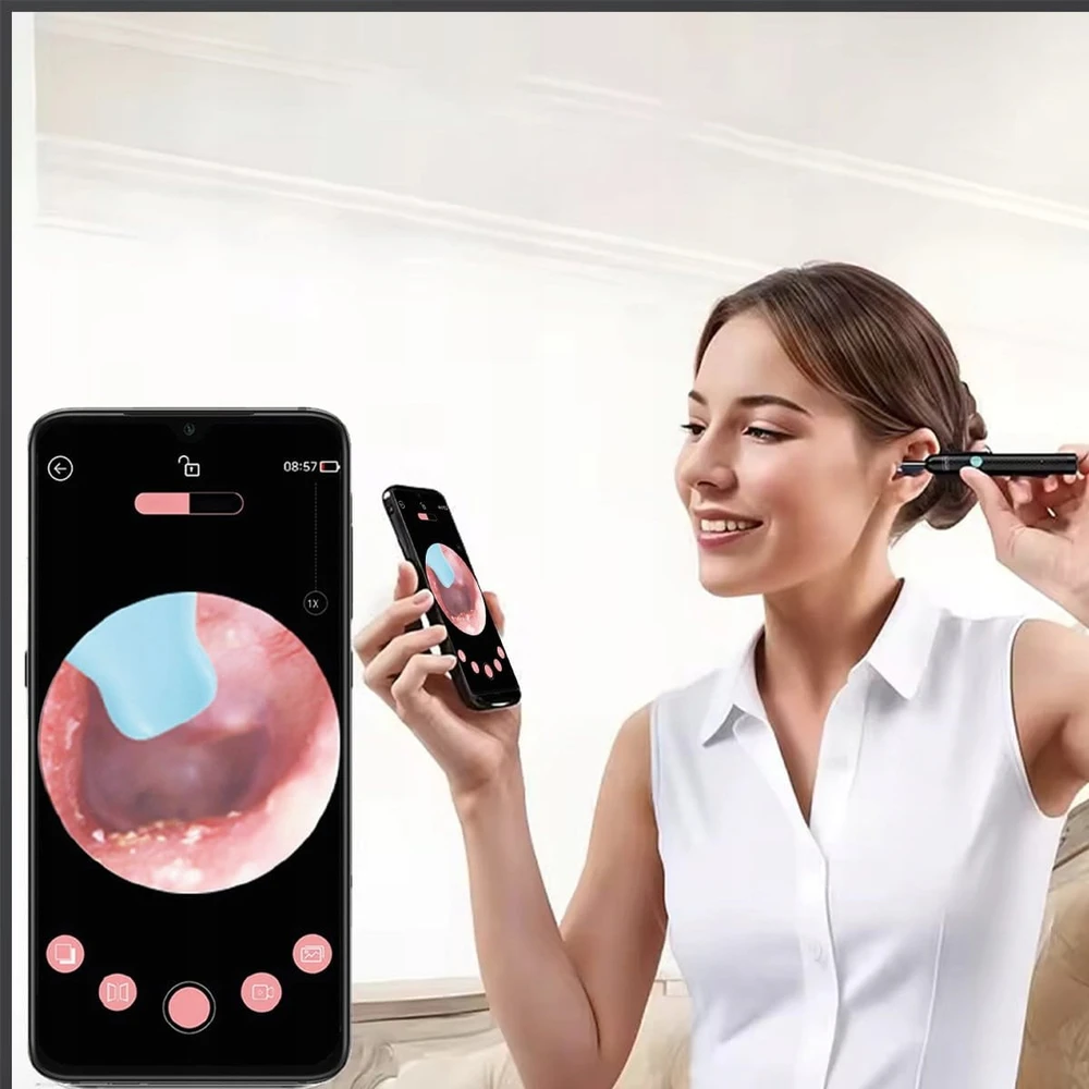 „Zenwire“ ausų valymo endoskopas otoskopas ausų sieros valymo prietaisas kamera WiFi SMART
