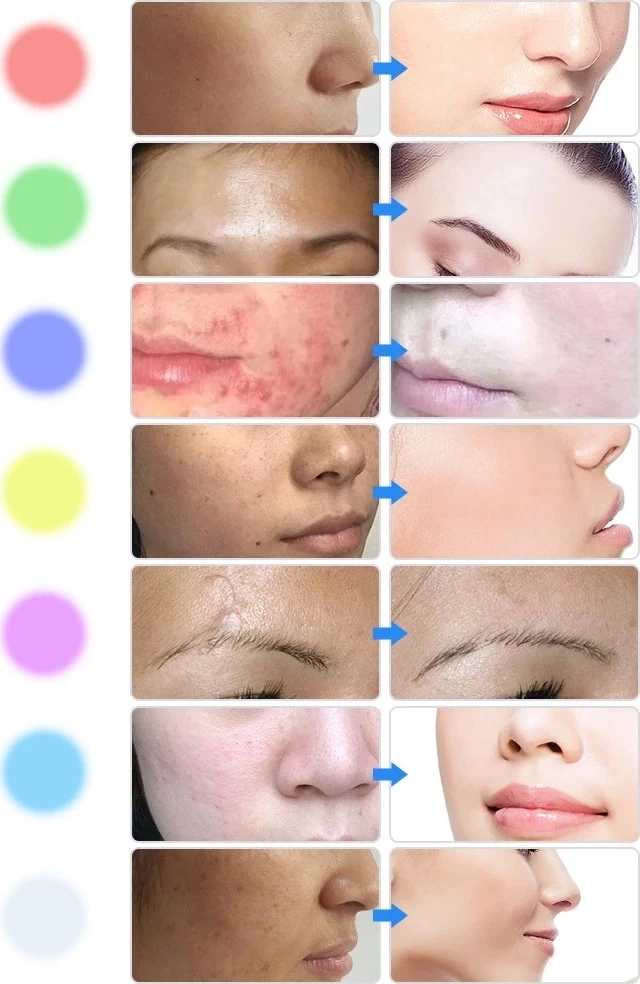 LED Light Therapy Face Mask inSPORTline Esgrima