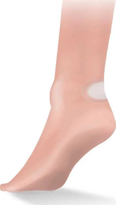 Pleistrų rinkinys Lifesystems Blister Plasters (6-pack)