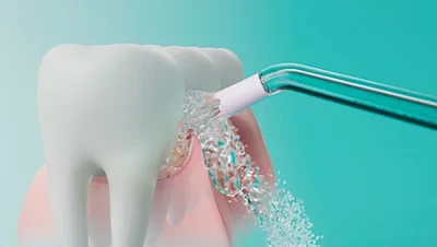 Irigatorius Philips Sonicare Power Flosser 7000 serijos HX3911/40, Baltos spalvos aprašymas - Prekės nuotrauka
