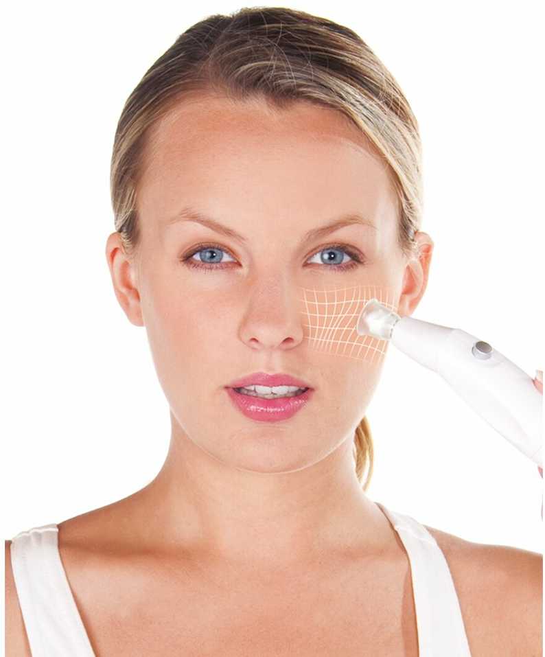 Vakuuminis veido ir kūno masažuoklis odos atjauninimui Lanaform Beauty Aspect