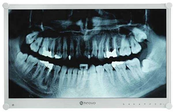 Neovo DR-24G DENTAL MONITORIUS