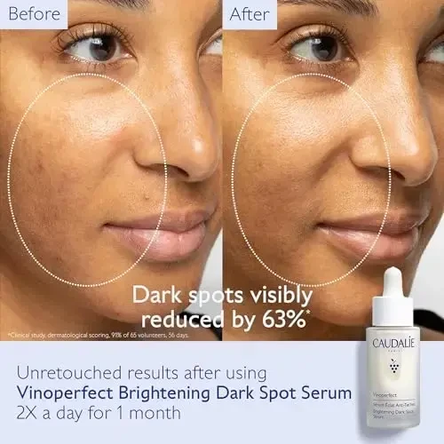 Caudalie Vinoperfect Radiance Serum Complexion Correcting, 30 ml