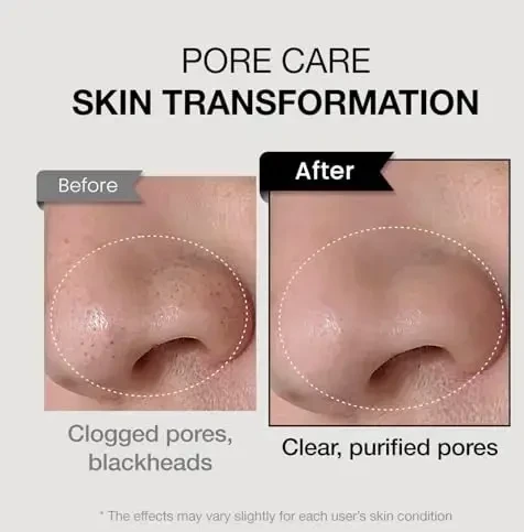Coxir TXA Mucin Pore Mask Valiklis putojanti kaukė porų valymui su traneksamo rūgštimi ir sraigių mucinu, 120 ml