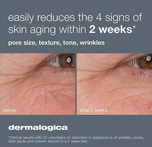 Dermalogica Dynamic Skin Retinol veido serumas nuo raukšlių, 30 ml
