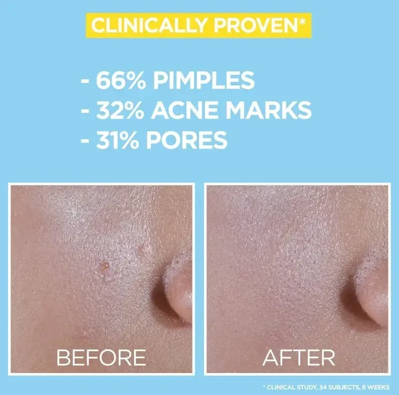 Garnier Grynas aktyvus BHA + niacinamidas Dieninis UV odos defektų šalinantis fluidas Kreminis
