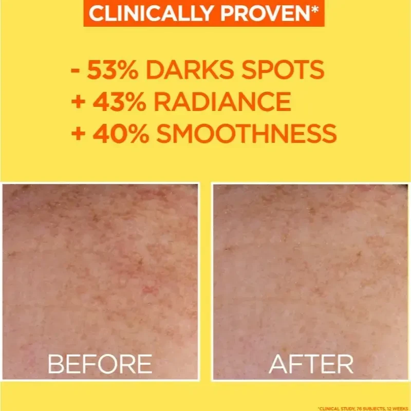 Garnier Skin Naturals vitamino C dieninis kremas su nematomu UV spinduliuote