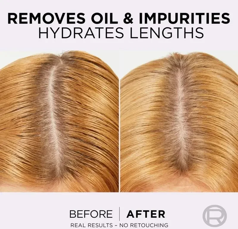 L'Oréal Paris Elseve Hyaluron Pure Šampūnas