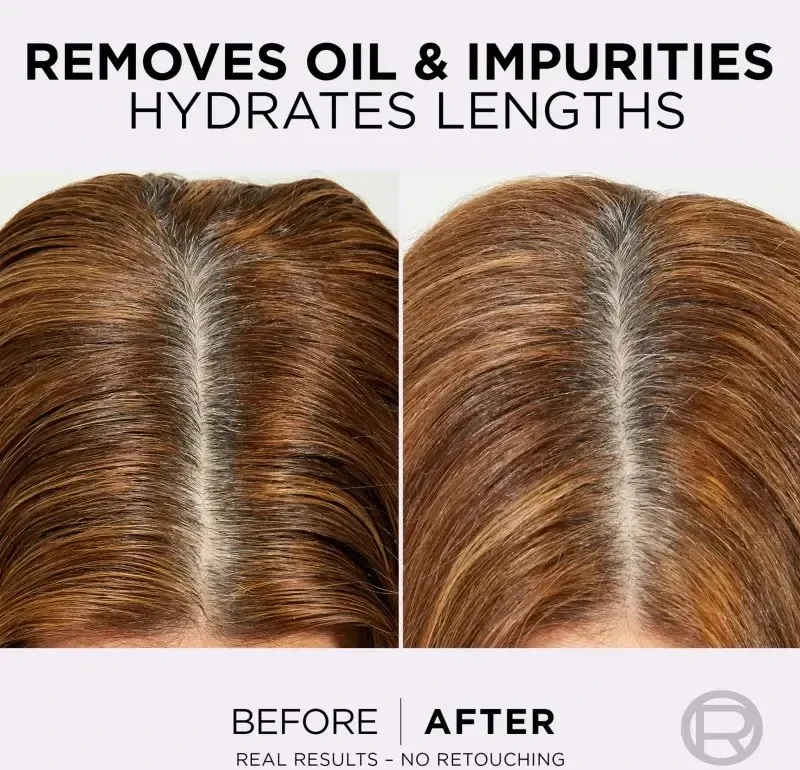 L'Oréal Paris Elseve Hyaluron Pure Šampūnas