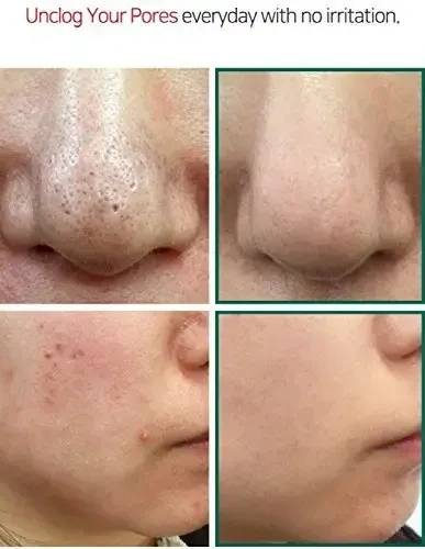 Some By Mi AHA BHA PHA 30 Days Miracle Cleansing Bar kietas prausiklis veidui su rūgštimis, 106 g