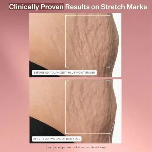 Strivectin SD Advanced Intensive Moisturizing Concentrate drėkinantis kremas nuo raukšlių ir strijų, 118 ml