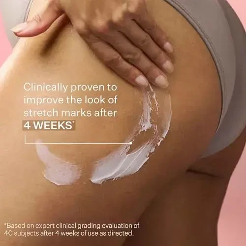 Strivectin SD Advanced Intensive Moisturizing Concentrate drėkinantis kremas nuo raukšlių ir strijų, 118 ml
