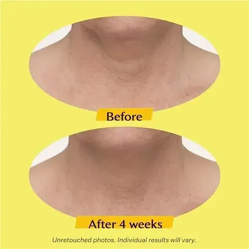 Strivectin TL Advanced Tightening Neck Kreminis koreguojantis kremas kaklui ir dekoltė, 30 ml