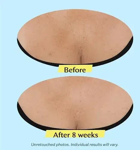 Strivectin TL Advanced Tightening Neck Kreminis koreguojantis kremas kaklui ir dekoltė, 30 ml