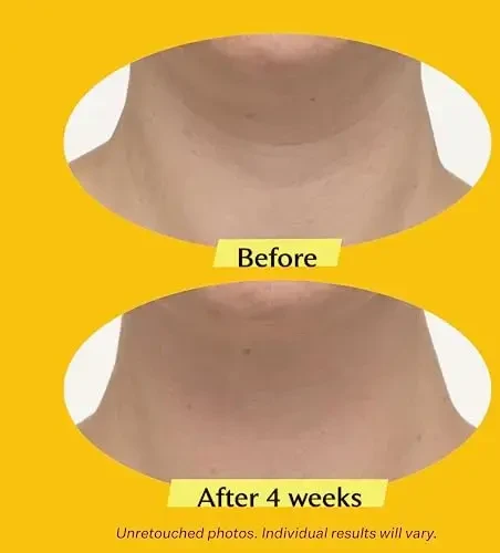 Strivectin TL Advanced Tightening Neck Kreminis koreguojantis kremas kaklui ir dekoltė, 30 ml