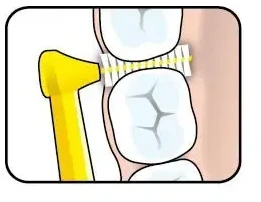 TePe Angle